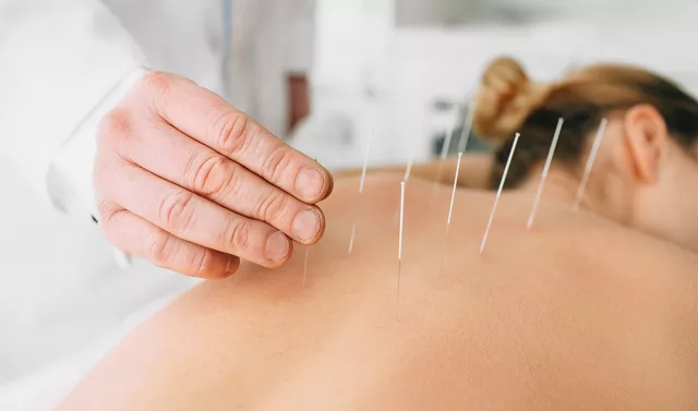 The Benefits of Acupuncture for Partial Onset Seizures